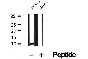 Western blot analysis of extracts of SKOV-3 cells, using SRP9 antibody. (SRP9 抗体  (Internal Region))