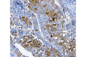 IHC analysis of FGFR2 using anti-FGFR2 antibody (ABIN7600690).