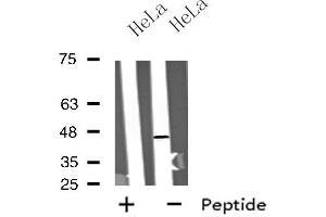 Western blot analysis of extracts from HeLa cells, using MTLR antibody. (Motilin Receptor 抗体  (C-Term))