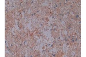 Immunohistochemistry (IHC) image for anti-Protein Kinase, AMP-Activated, alpha 1 Catalytic Subunit (PRKAA1) (AA 28-257) antibody (ABIN7440413)