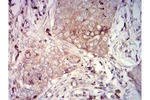 Immunohistochemistry (IHC) image for anti-Carcinoembryonic Antigen-Related Cell Adhesion Molecule 1 (CEACAM1) (AA 65-201) antibody (ABIN5684132)