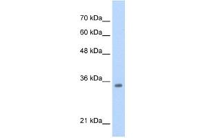 WB Suggested Anti-TCF4 Antibody  Titration: 0. (TCF4 抗体  (N-Term))