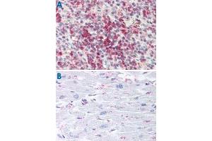 Immunohistochemistry (Formalin/PFA-fixed paraffin-embedded sections) of human spleen (A) and human heart tissue (B) with CYSLTR2 polyclonal antibody . (CasLTR2 抗体  (C-Term))