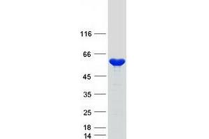 Western Blotting (WB) image for Nucleosome Assembly Protein 1-Like 4 (NAP1L4) protein (Myc-DYKDDDDK Tag) (ABIN2726808)