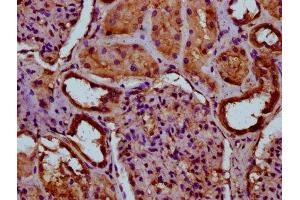 IHC image of ABIN7156513 diluted at 1:100 and staining in paraffin-embedded human kidney tissue performed on a Leica BondTM system. (ITIH3 抗体  (AA 512-651))