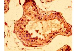 IHC image of ABIN7148050 diluted at 1:300 and staining in paraffin-embedded human testis tissue performed on a Leica BondTM system. (STAG3 抗体  (AA 1056-1212))