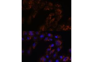 Immunofluorescence (IF) image for anti-Transmembrane Emp24 Protein Transport Domain Containing 3 (TMED3) (AA 24-180) antibody (ABIN7270944)