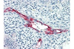 Immunohistochemistry (IHC) image for anti-Coagulation Factor VIII (F8) antibody (ABIN614478) (Factor VIII 抗体)