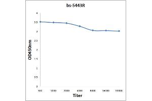 Antigen: 0. (ILK 抗体  (pThr173))