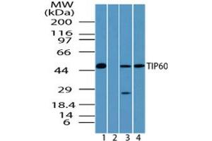 Image no. 2 for anti-K(lysine) Acetyltransferase 5 (KAT5) (AA 480-530) antibody (ABIN960242) (KAT5 抗体  (AA 480-530))