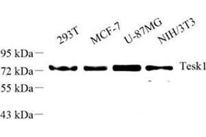 Western blot analysis of tesk1 (ABIN7075866) at dilution of 1: 500