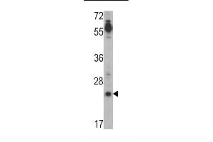 Western blot analysis of CRIPTO (TDGF1) Antibody (N-term) (ABIN388791 and ABIN2839123) in Jurkat cell line lysates (35 μg/lane). (TDGF1 抗体  (N-Term))