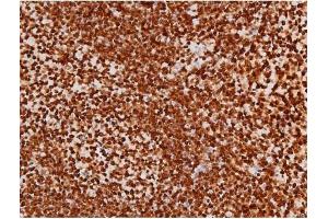 Immunohistochemistry (IHC) image for anti-Mast/stem Cell Growth Factor Receptor (KIT) (pTyr721) antibody (ABIN6256004)