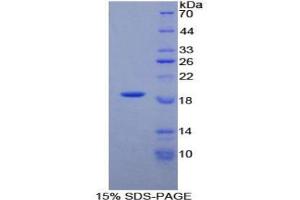 SDS-PAGE analysis of Human PLAA Protein. (PLAA 蛋白)
