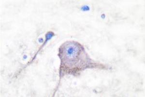 Image no. 2 for anti-Synaptosomal-Associated Protein, 25kDa (SNAP25) antibody (ABIN271818) (SNAP25 抗体)