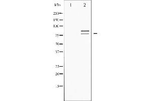 Western blot analysis of HSL phosphorylation expression in Adriamyci treated HeLa whole cell lysates,The lane on the left is treated with the antigen-specific peptide. (LIPE 抗体  (pSer554, pSer855))