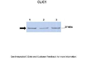 Lanes:   Lane 1: 30ug mouse renal epithelial lysate Lane 2: 30ug mouse renal epithelial lysate Lane 3: 30ug mouse renal epithelial lysate  Primary Antibody Dilution:   1:500  Secondary Antibody:   Anti-rabbit-HRP  Secondary Antibody Dilution:   1:2500  Gene Name:   CLIC1  Submitted by:   Dr. (CLIC1 抗体  (C-Term))