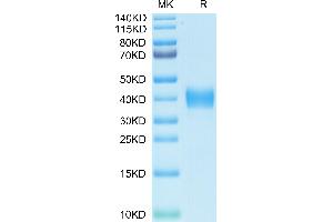 Biotinylated SARS RBD on Tris-Bis PAGE under reduced condition. (SARS-CoV Spike Protein (RBD) (His-Avi Tag,Biotin))