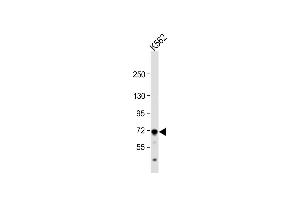 Anti-MC Antibody (Center) at 1:1000 dilution + K562 whole cell lysate Lysates/proteins at 20 μg per lane. (MCAM 抗体  (AA 161-189))