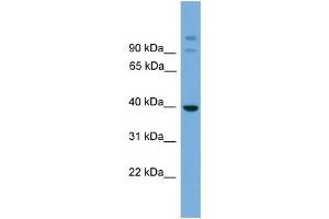 WB Suggested Anti-SUGT1 Antibody Titration: 0. (SUGT1 抗体  (Middle Region))