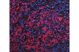 IF analysis of Cytokeratin 20/Krt20 using anti-Cytokeratin 20/Krt20 antibody (ABIN7601133). (KRT20 抗体  (AA 29-431))