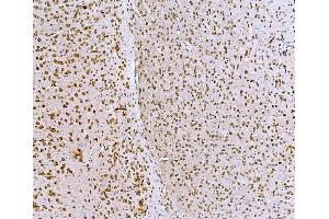 IHC analysis of BCKDHA using anti-BCKDHA antibody (ABIN7601223).