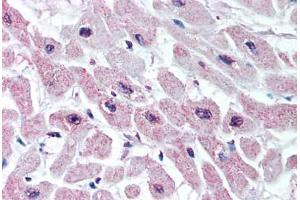 Immunohistochemistry (IHC) image for anti-Potassium Inwardly-Rectifying Channel, Subfamily J, Member 3 (KCNJ3) (Internal Region) antibody (ABIN1048661)