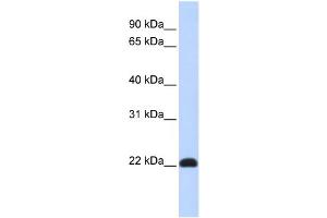 WB Suggested Anti-KLF16 Antibody Titration:  0. (KLF16 抗体  (N-Term))