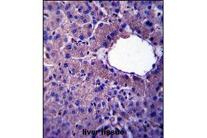 LIN52 Antibody (N-term) (ABIN657405 and ABIN2846445) immunohistochemistry analysis in formalin fixed and paraffin embedded human liver tissue followed by peroxidase conjugation of the secondary antibody and DAB staining. (LIN52 抗体  (N-Term))