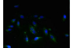 Immunofluorescent analysis of Hela cells using ABIN7159505 at dilution of 1:100 and Alexa Fluor 488-congugated AffiniPure Goat Anti-Rabbit IgG(H+L) (STEAP3 抗体  (AA 1-207))
