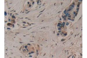 Used in DAB staining on fromalin fixed paraffin- embedded liver tissue (LIFR 抗体  (AA 45-184))