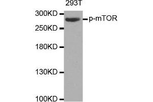 Western blot analysis of extracts of 293T cell line, using phospho-MTOR-S2448 antibody. (MTOR 抗体  (pSer2448))