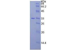 Image no. 1 for Janus Kinase 3 (JAK3) (AA 716-967) (Active) protein (His tag) (ABIN6239869)