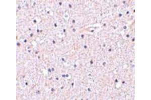 Immunohistochemistry of NCSTN in human brain tissue with NCSTN polyclonal antibody  at 5 ug/mL . (Nicastrin 抗体  (C-Term))