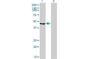 Western Blot analysis of ENO3 expression in transfected 293T cell line by ENO3 monoclonal antibody (M01), clone 5D1. (ENO3 抗体  (AA 228-277))