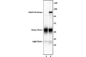 OGA/O-GlcNAcase antibody (pAb) tested by Immunoprecipitation. (MGEA5 抗体  (N-Term))