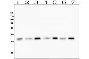 Western blot analysis of Cofilin-2 using anti-Cofilin-2 antibody (ABIN7602747).