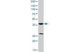FRZB MaxPab rabbit polyclonal antibody. (FRZB 抗体  (AA 1-325))