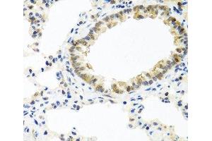Immunohistochemistry of paraffin-embedded Rat lung using BMP5 Polyclonal Antibody at dilution of 1:100 (40x lens). (BMP5 抗体)