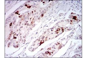 Immunohistochemistry (IHC) image for anti-Telomeric Repeat Binding Factor 2 (TERF2) (AA 324-500) antibody (ABIN1724941)