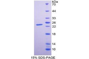 Image no. 1 for Interleukin 29 (IL29) (AA 20-200) protein (His tag) (ABIN6236816) (IL29 Protein (AA 20-200) (His tag))