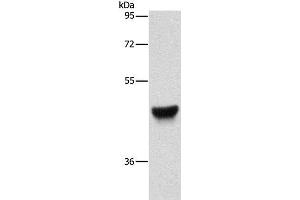 Western Blot analysis of Human esophagus cancer tissue using CK-13 Polyclonal Antibody at dilution of 1:500 (Cytokeratin 13 抗体)