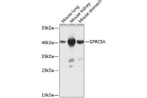 Western blot analysis of extracts of various cell lines, using GPRC5A antibody (ABIN6131897, ABIN6141357, ABIN6141358 and ABIN6224198) at 1:1000 dilution. (GPRC5A 抗体  (AA 258-357))