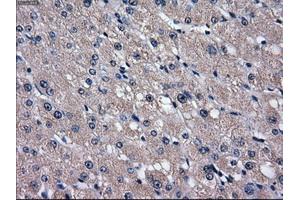 Immunohistochemical staining of paraffin-embedded liver tissue using anti-SLC2A5mouse monoclonal antibody. (SLC2A5 抗体)