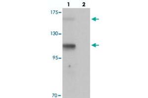 Western blot analysis of RUSC2 in SK-N-SH cell lysate with RUSC2 polyclonal antibody  at 1 ug/mL in (lane 1) the absence and (lane 2) the presence of blocking peptide. (RUSC2 抗体  (N-Term))