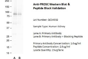 Host: Rabbit Target Name: PROSC Sample Type: Human Kidney  Lane A: Primary Antibody  Lane B: Primary Antibody + Blocking Peptide  Primary Antibody Concentration: 1. (PROSC 抗体  (C-Term))