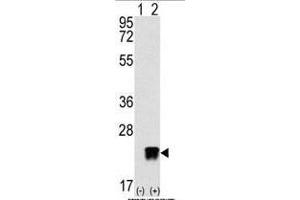 Western blot analysis of ARL3 (arrow) using rabbit polyclonal ARL3 Antibody (C-term) (ABIN389001 and ABIN2839231). (ARL3 抗体  (C-Term))