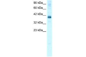 WB Suggested Anti-TSC22D4 Antibody Titration: 0. (TSC22D4 抗体  (N-Term))