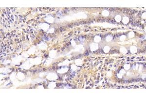 Detection of ST2 in Human Small intestine Tissue using Monoclonal Antibody to Syntenin 2 (ST2) (SDCBP2 抗体  (AA 1-292))