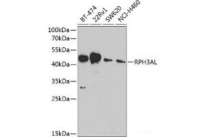 Western blot analysis of extracts of various cell lines using RPH3AL Polyclonal Antibody at dilution of 1:1000. (RPH3AL 抗体)